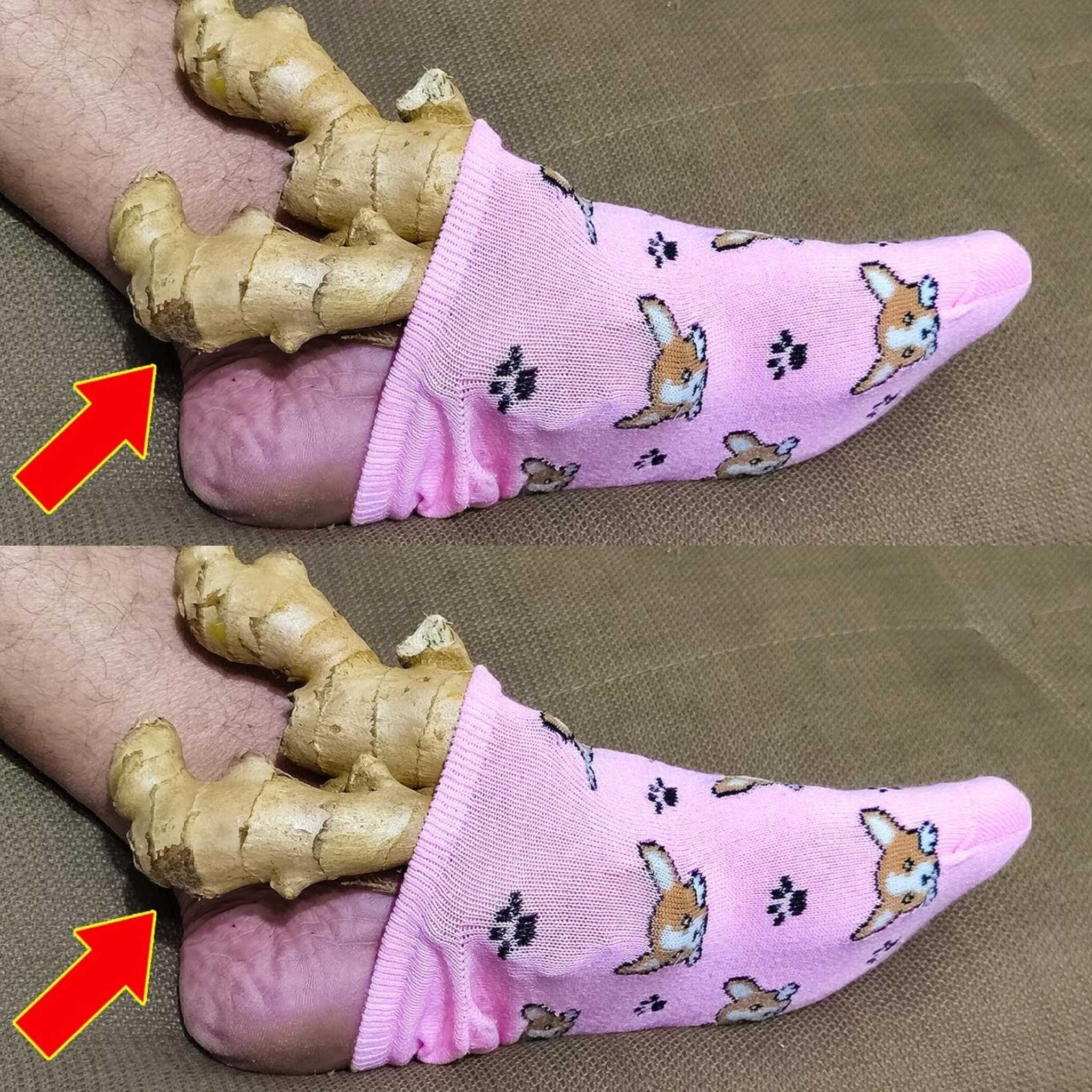 Put 1 Ginger on Your Feet and Stop Spending Money at the Pharmacy (Did You Know That?)